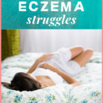 Life update – eczema health struggles