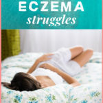 Life update – eczema and arthritis health struggles