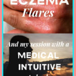 Eczema Flares and my Session with a Medical Intuitive to Heal