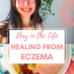 Day in the life healing from eczema